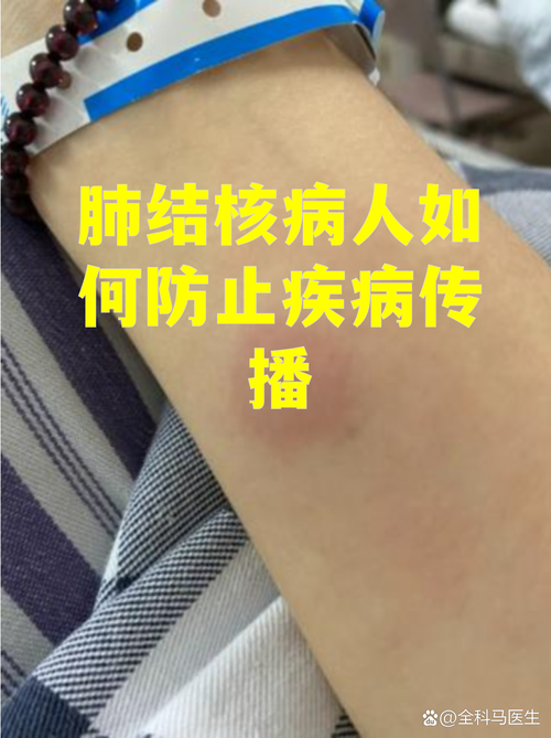 皖东小城的防控风暴：明光市1例确诊病例背后的区域传播链