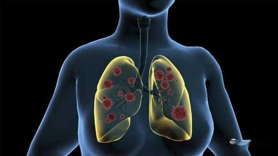 【31省份多点散发，广西博白5例引防控关注】