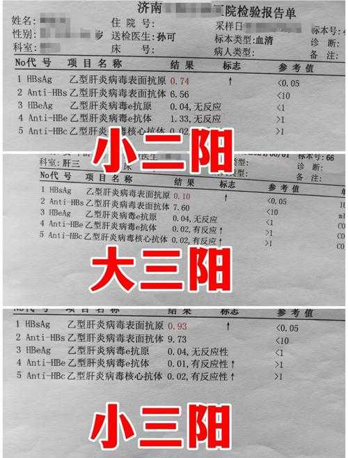 2020-2022新冠疫情期间二阳三阳嗓子疼是否复阳？福建专家权威解析