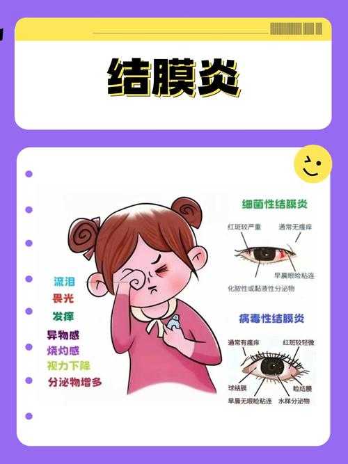 【新冠疫情期间上海优势流行株结膜炎应对策略及防控要点】