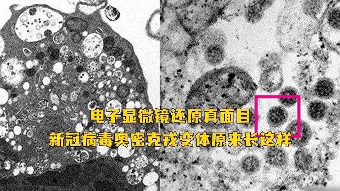 奥密克戎JN1低烧反复特征及复阳鉴别要点解析