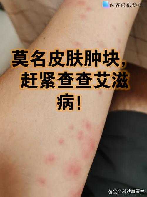 江西疫情低谷中的异军突起：崇义县确诊2例暴露防控盲区