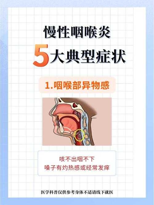 2020-2022新冠疫情期间咽喉肿痛应对策略