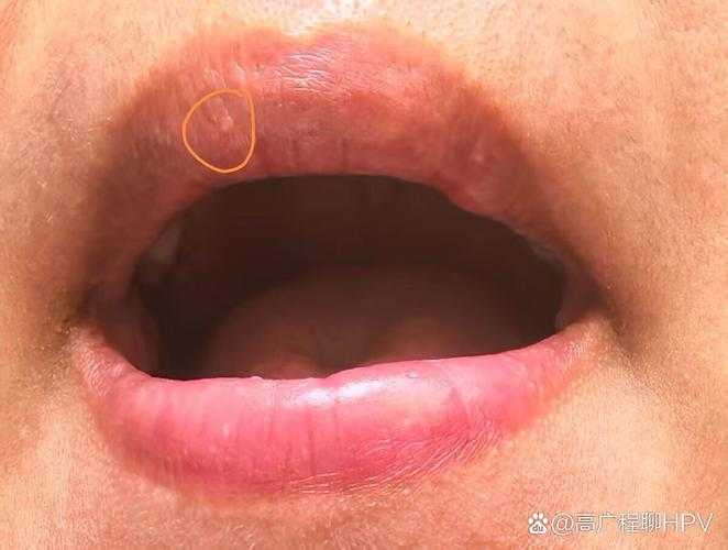 山东防控网现破口:安丘5例确诊背后的传播链