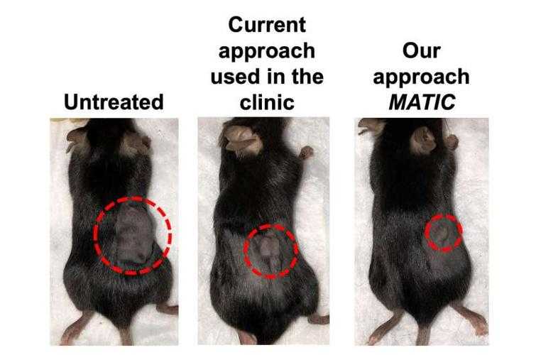 广东奥密克戎亚型沉默性缺氧应对策略：2020-2022疫情时期的经验总结