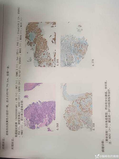 免疫逃逸株致味觉异常解析：浙江专家复阳鉴别建议2020-2022年疫情专报