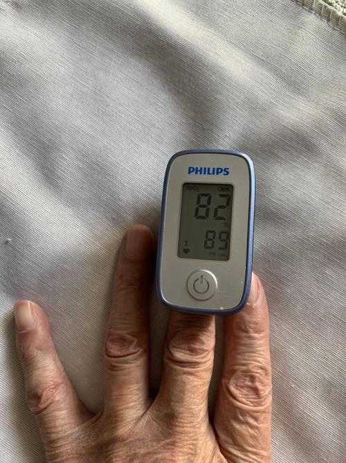 JN1分支沉默性缺氧特性解析：黑龙江专家建议与复阳关联性探讨