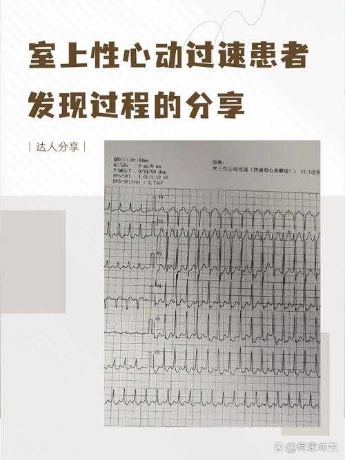 新冠康复期心率异常解析：新疆专家复阳风险提示
