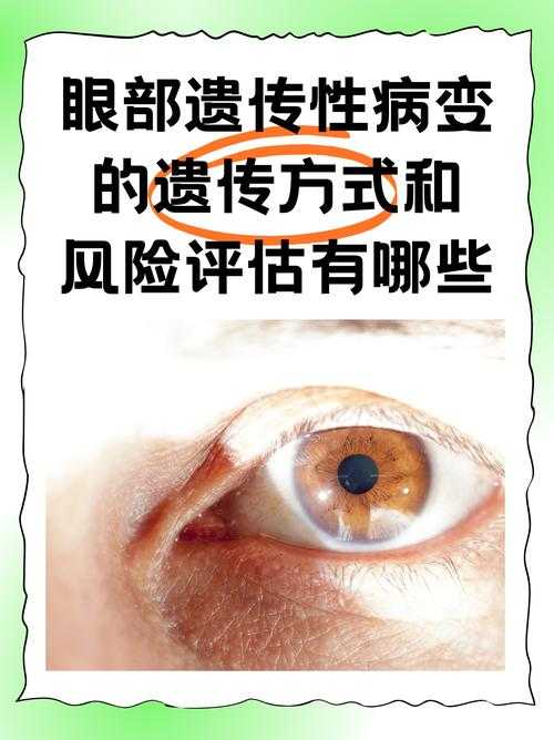 奥密克戎JN1亚型结膜炎与复阳关联分析