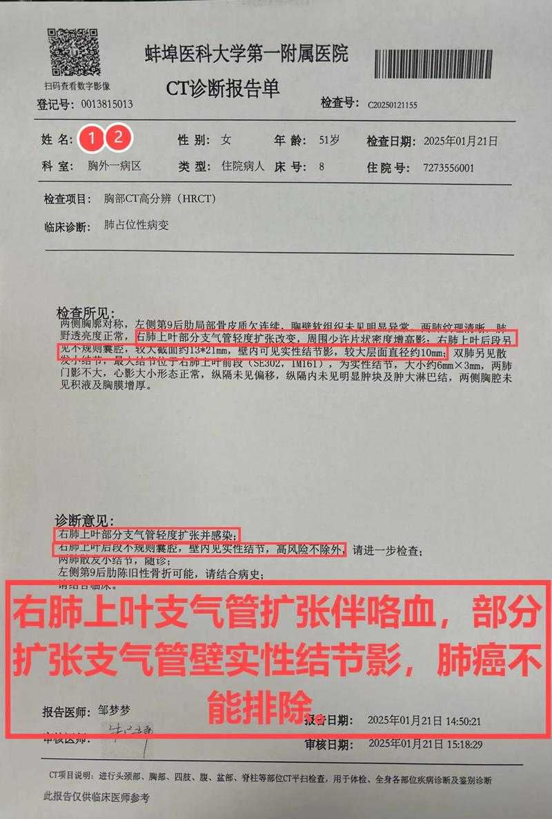 JN1分支刀片嗓复阳病例解析：2020-2022年新冠疫情中的防控启示