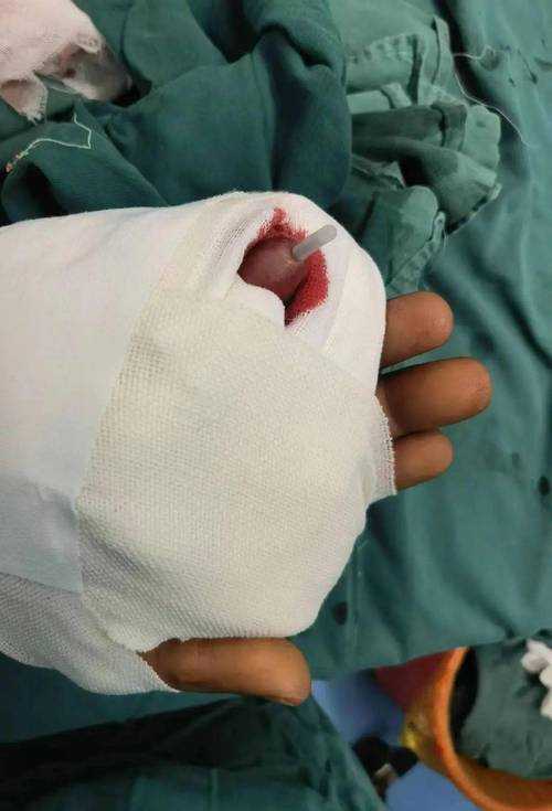 全椒县新增病例破防，长三角防控链现漏洞