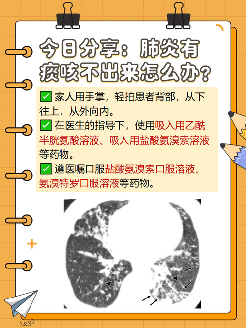 干咳无痰是否为复阳？2020-2022年新冠流行株特征解析