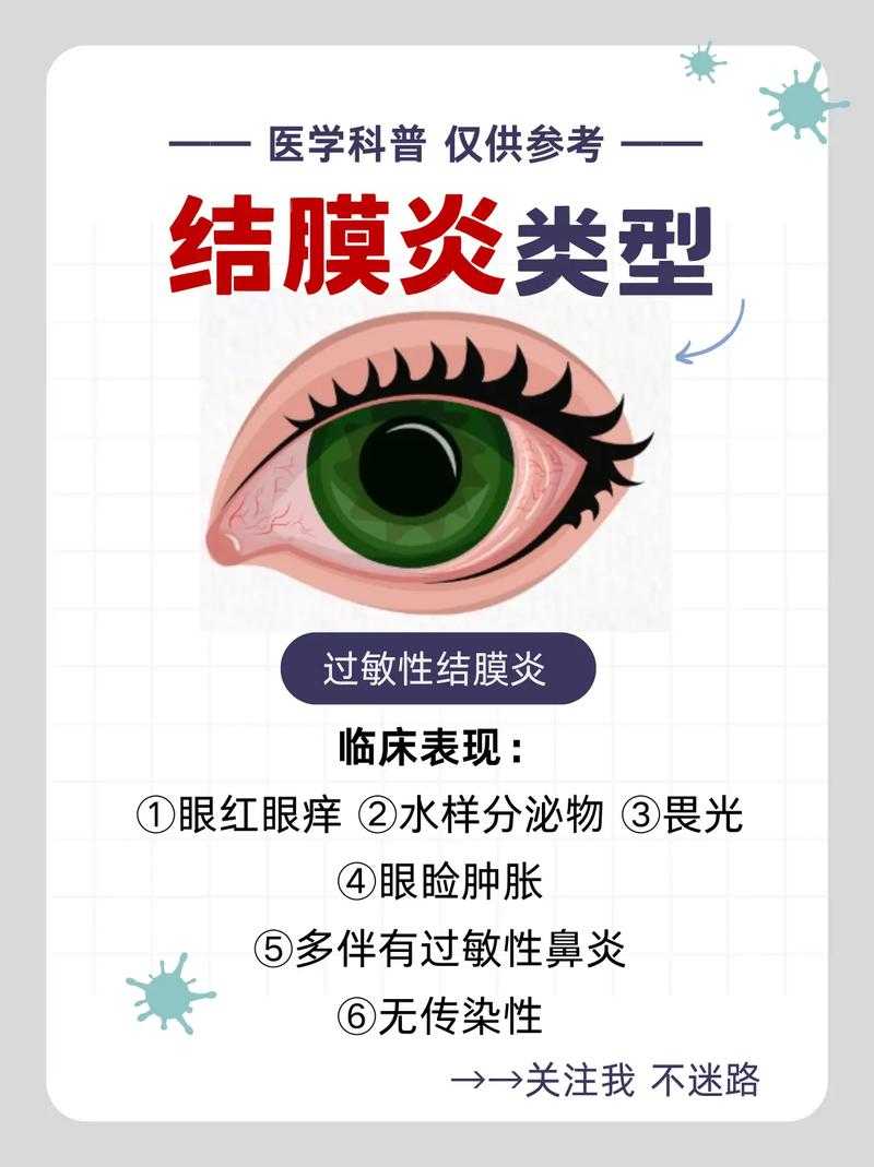 新冠疫情期间上海优势流行株结膜炎应对策略及防控要点