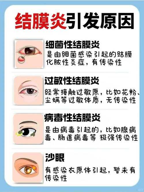 2020-2022新冠疫情期间杭州奥密克戎亚型结膜炎应对指南