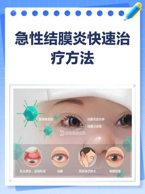 新冠疫情期间上海JN1分支结膜炎应对指南