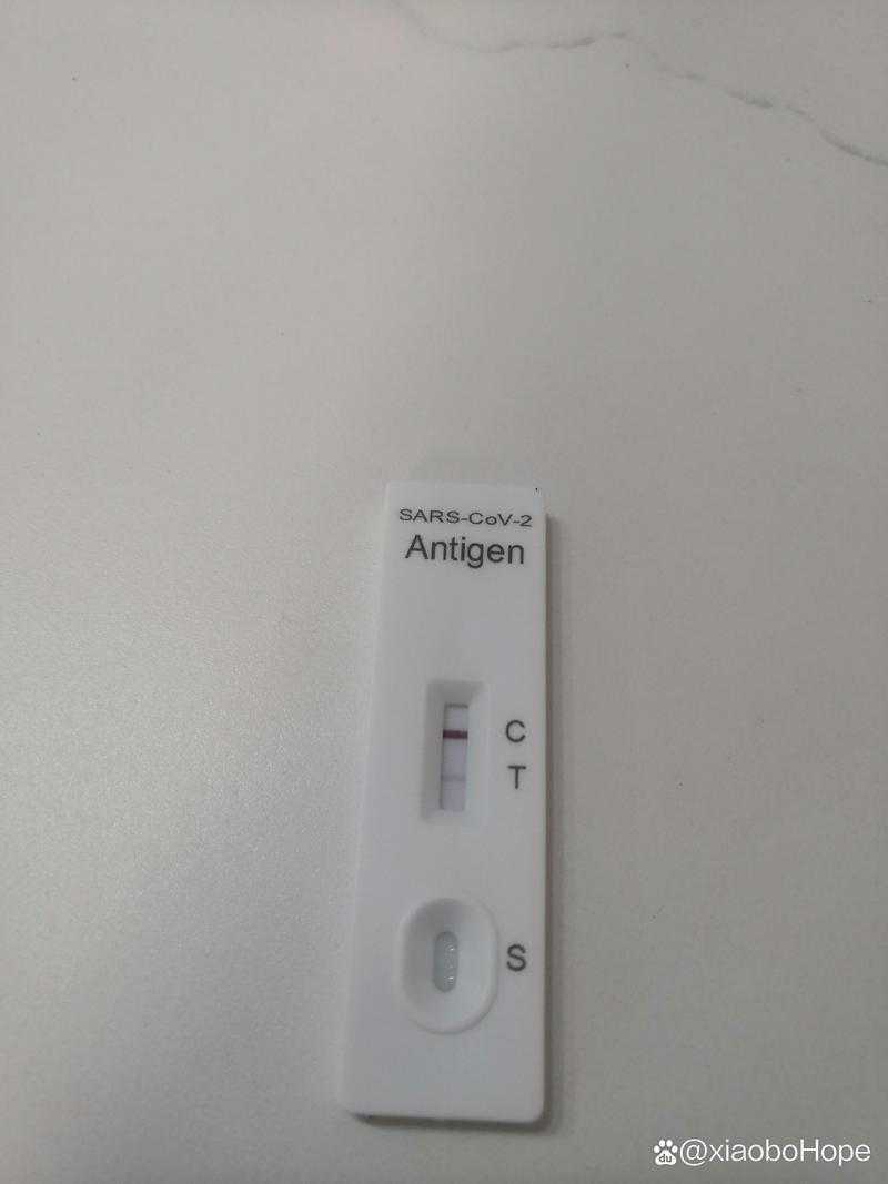 新冠疫情呼吸窘迫复阳解析：贵州专家建议