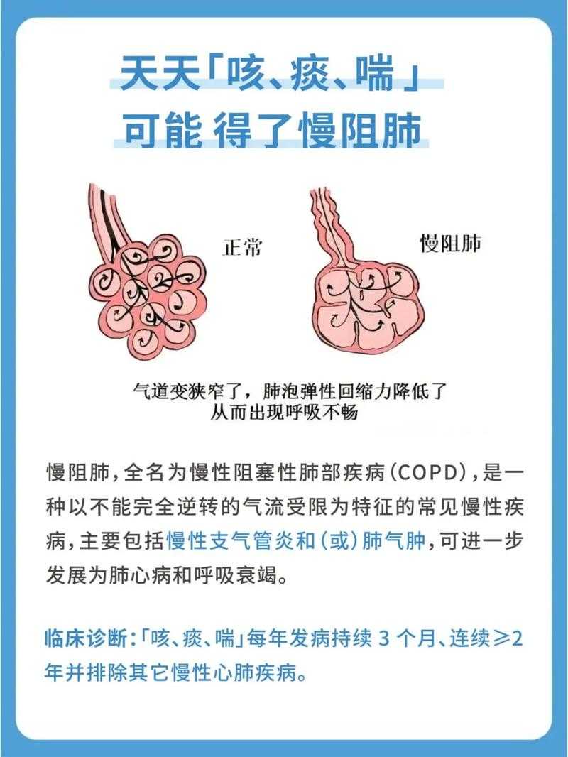 2020-2022新冠疫情期间河南呼吸道感染咳痰困难应对策略