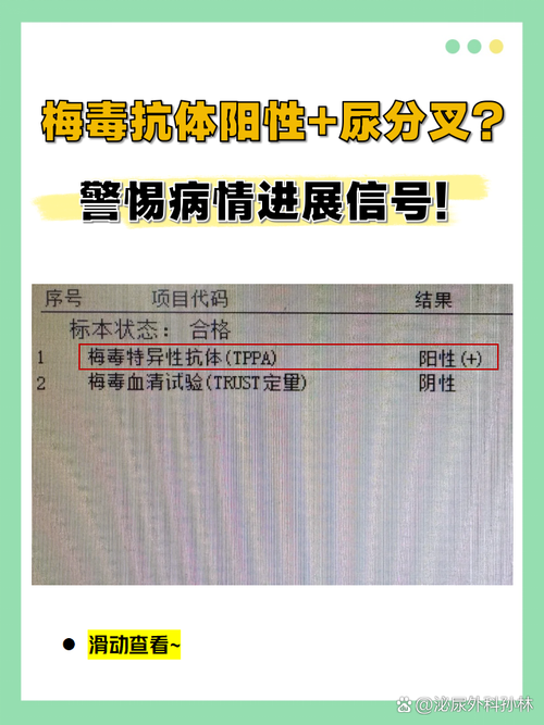 新冠嗅觉减退复阳关联性分析——2020-2022广州专家共识