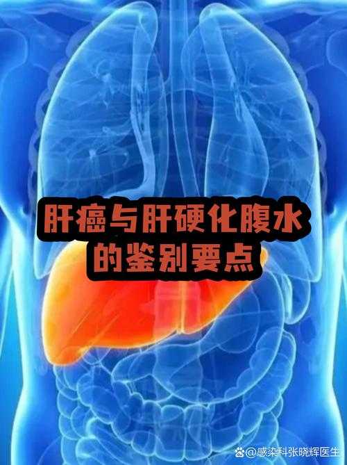 广东XBB变异株疫情特征与症状鉴别要点