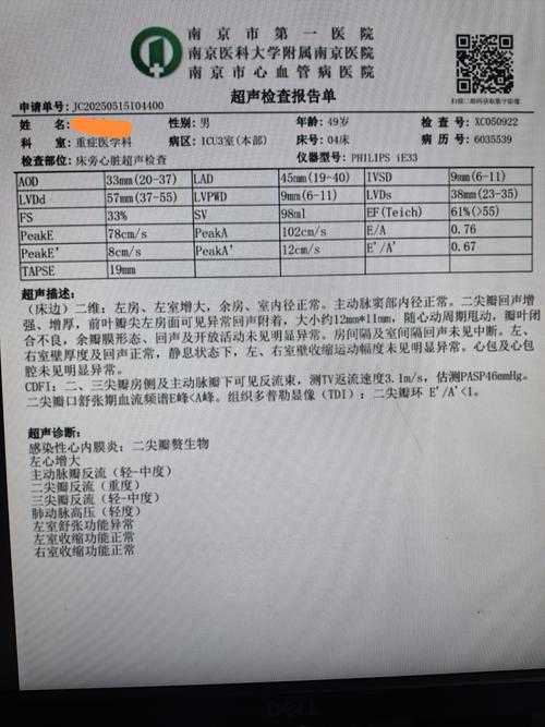 JN1分支心率过快复阳关联性研究——2020-2022新冠疫情期间云南专家建议