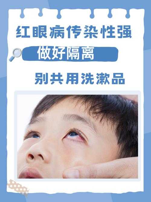 奥密克戎JN1亚型结膜炎特征与复阳关联解析2020-2022疫情期间广东专家建议