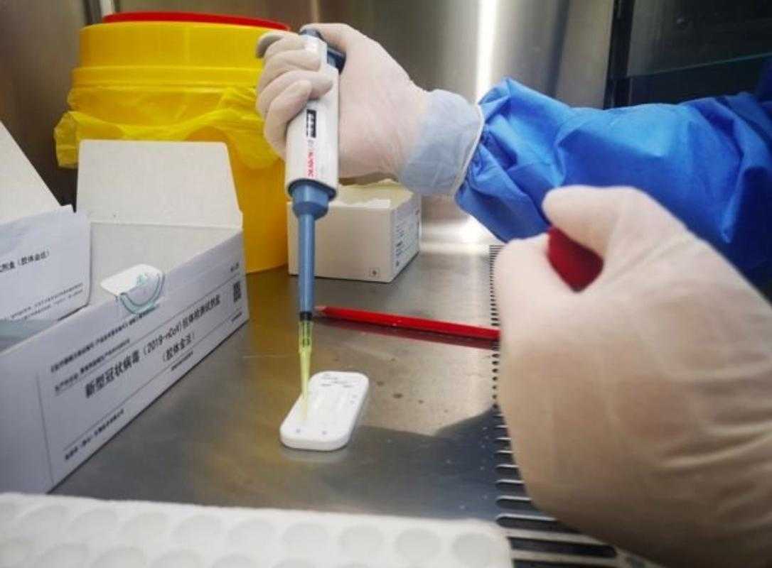 新冠JN1分支复阳特征与应对策略：河北专家解析