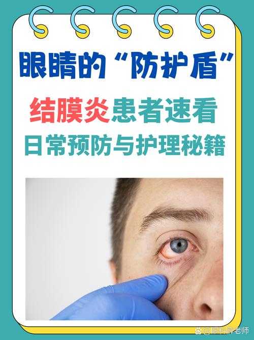 新冠疫情期间海南二阳三阳结膜炎应对指南