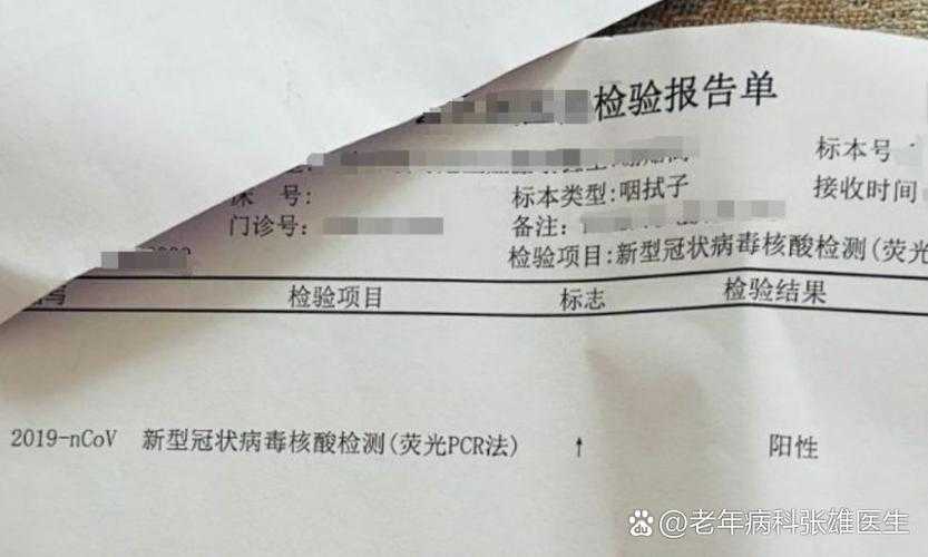 新疆奥密克戎JN1变异株感染者恢复期特征与防控要点