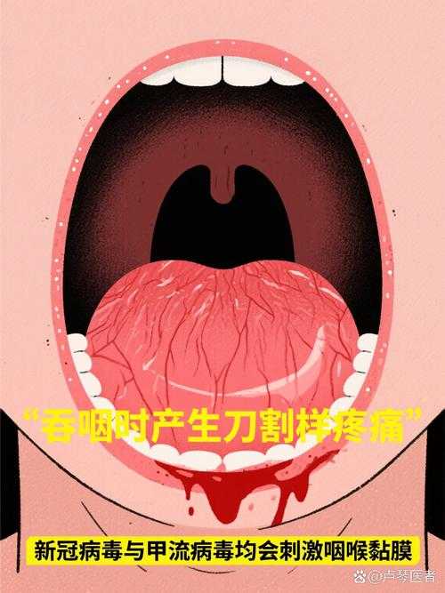 变异毒株防控要点：“刀片嗓”症状再现需警惕——新疆专家建议解析