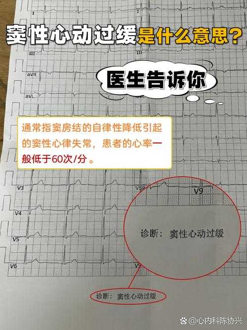奥密克戎亚型心率异常解析:复阳误判与宁夏专家建议