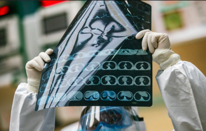 31省份多点散发，江苏海州5例为何成防控焦点？