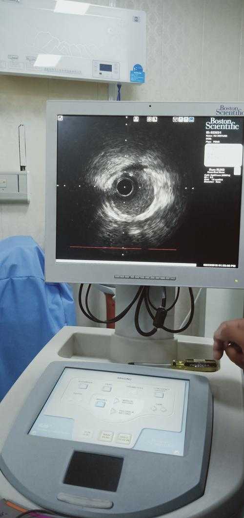 德昌县新增8例确诊背后的防控盲区