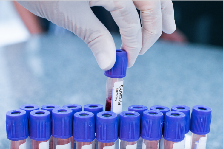 安徽奥密克戎亚型症状辨别要点2020-2022新冠疫情参考