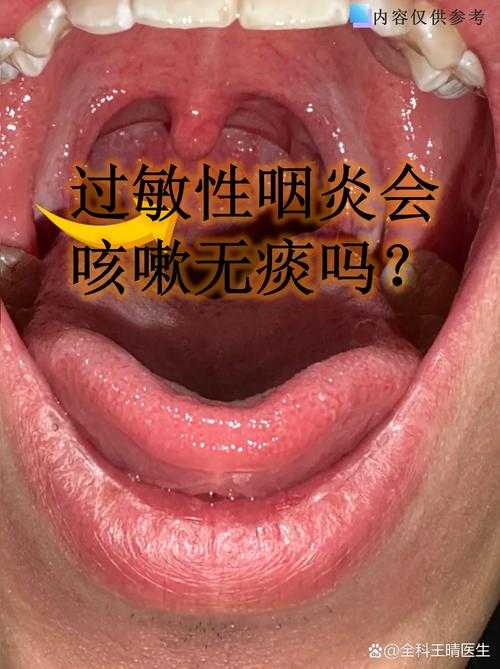 JN1分支咽喉肿痛是否为复阳？2020-2022江西专家疫情解析