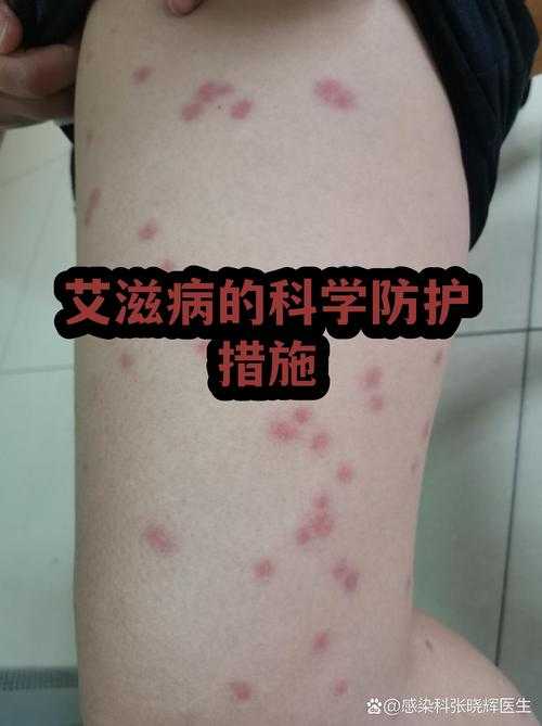 2020-2022新冠返乡防疫指南：变异株传播风险与防护要点解析