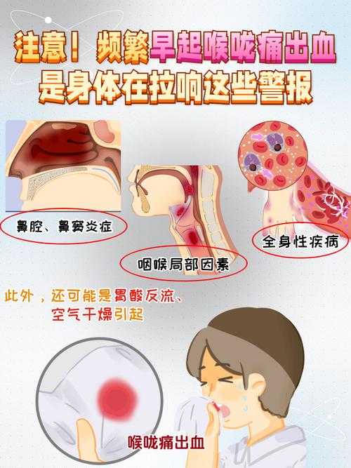 【新型冠状病毒患者吞咽困难症状解析及内蒙古专家建议】
