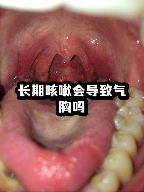 光泽县新增5例确诊病例，周边地级市防控压力骤升