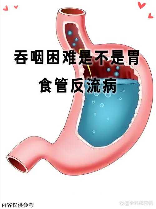 宁夏地区新冠患者吞咽困难应对策略2020-2022疫情实录