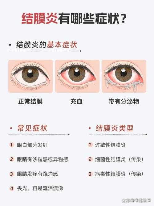 新冠疫情中农村地区优势流行株结膜炎防控策略