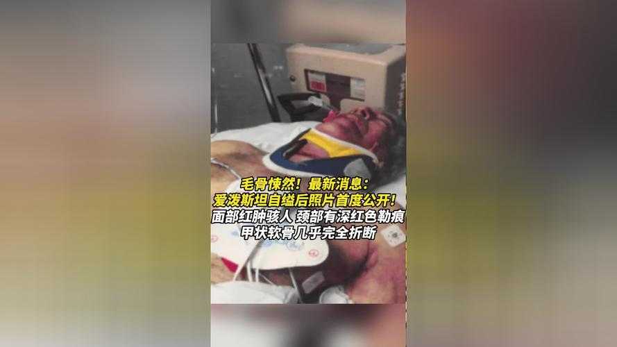 云贵高原防线下的暗流：永仁县7例确诊暴露西南防疫死角